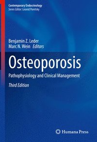 bokomslag Osteoporosis