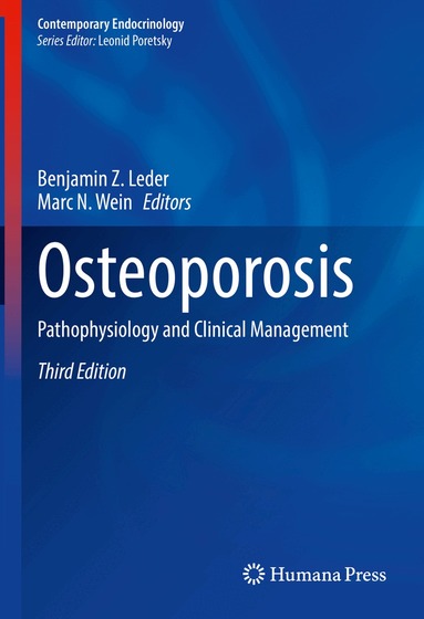 Benjamin Z. Leder, Marc N. Wein - Osteoporosis, Inbunden