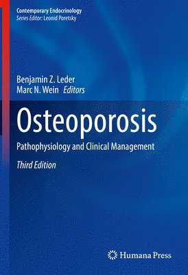 Benjamin Z. Leder, Marc N. Wein - Osteoporosis, Inbunden