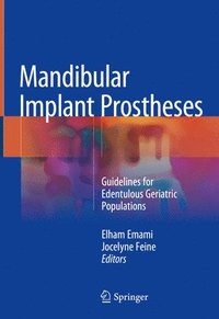 bokomslag Mandibular Implant Prostheses