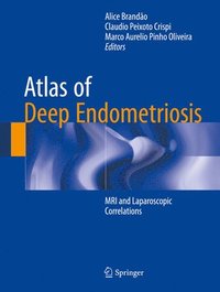 bokomslag Atlas of Deep Endometriosis