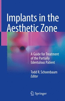 Implants in the Aesthetic Zone 1