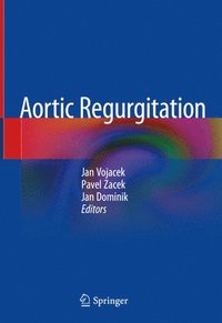 bokomslag Aortic Regurgitation