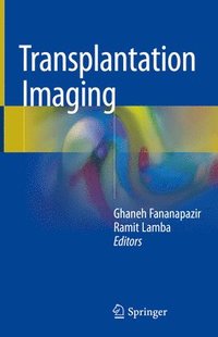 bokomslag Transplantation Imaging