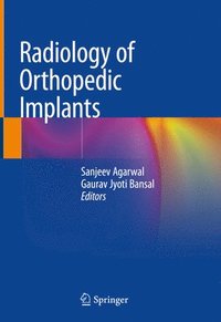 bokomslag Radiology of Orthopedic Implants