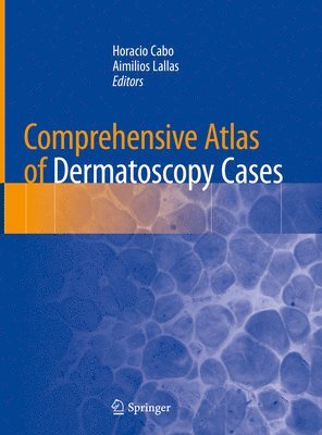 bokomslag Comprehensive Atlas of Dermatoscopy Cases