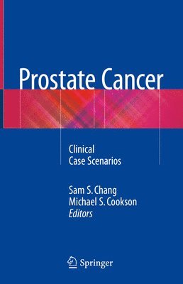 bokomslag Prostate Cancer