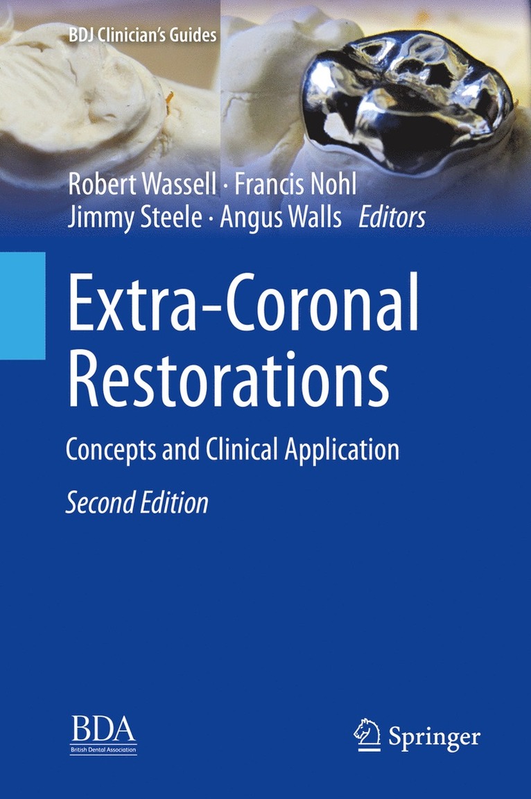 Robert Wassell, Francis Nohl, Jimmy Steele, Angus Walls - Extra-Coronal Restorations, Inbunden