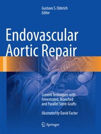 bokomslag Endovascular Aortic Repair