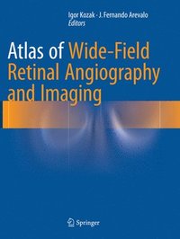 bokomslag Atlas of Wide-Field Retinal Angiography and Imaging