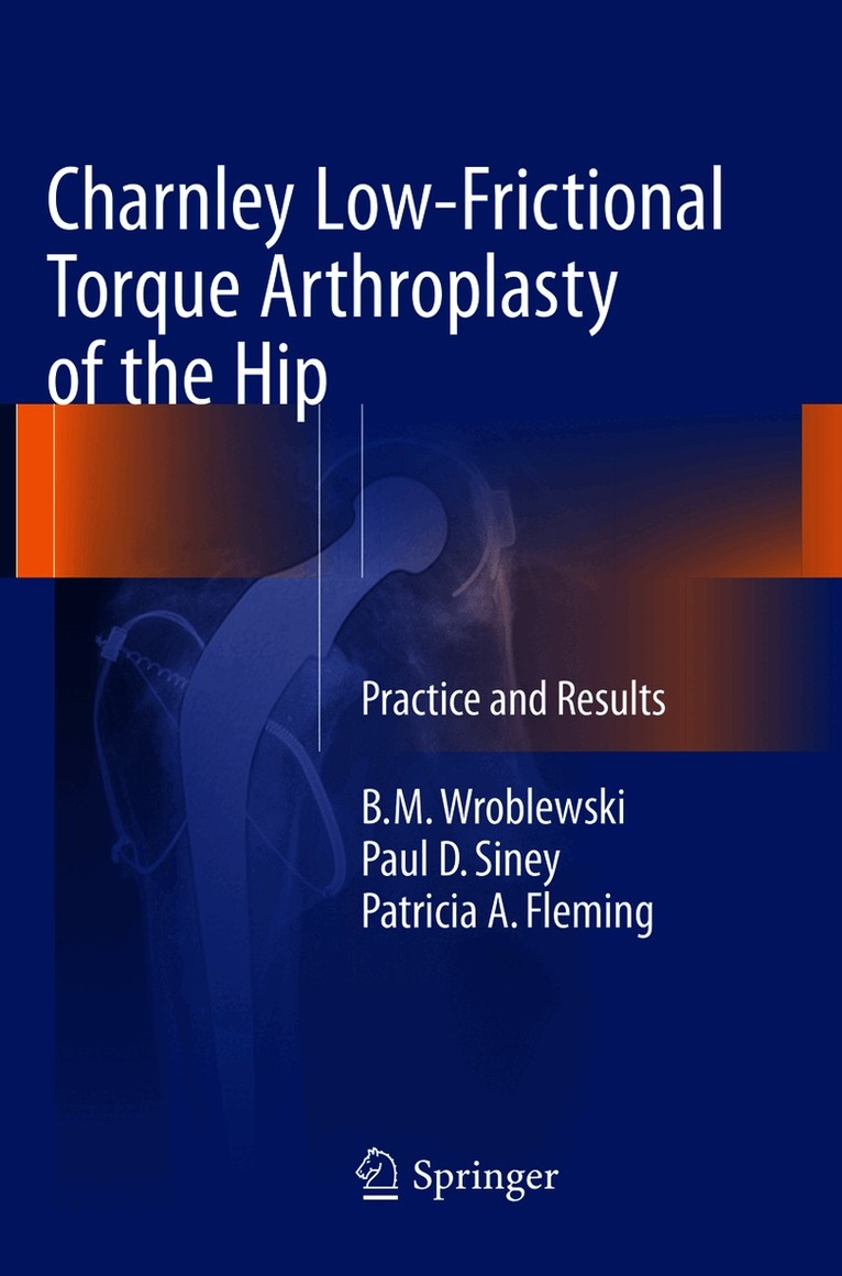 Charnley Low-Frictional Torque Arthroplasty of the Hip