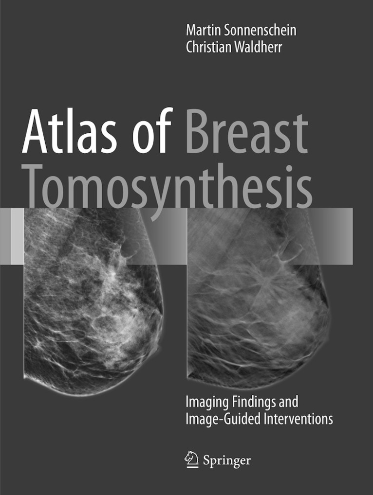 Martin Sonnenschein, Christian Waldherr - Atlas of Breast Tomosynthesis, Häftad