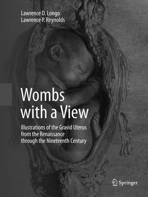 Wombs with a View 1