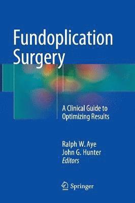 Fundoplication Surgery 1