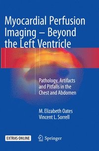 bokomslag Myocardial Perfusion Imaging - Beyond the Left Ventricle