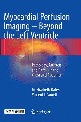 bokomslag Myocardial Perfusion Imaging - Beyond the Left Ventricle