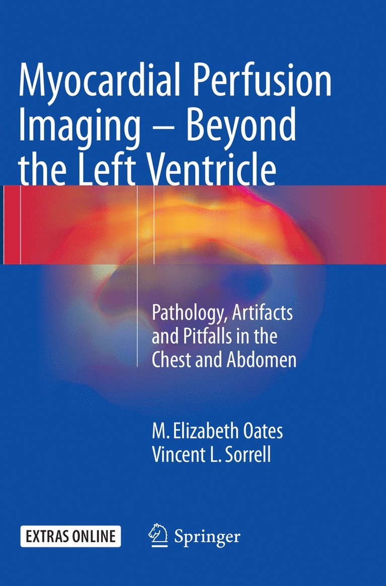 M. Elizabeth Oates, Vincent L. Sorrell - Myocardial Perfusion Imaging - Beyond the Left Ventricle, Häftad