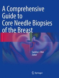 bokomslag A Comprehensive Guide to Core Needle Biopsies of the Breast