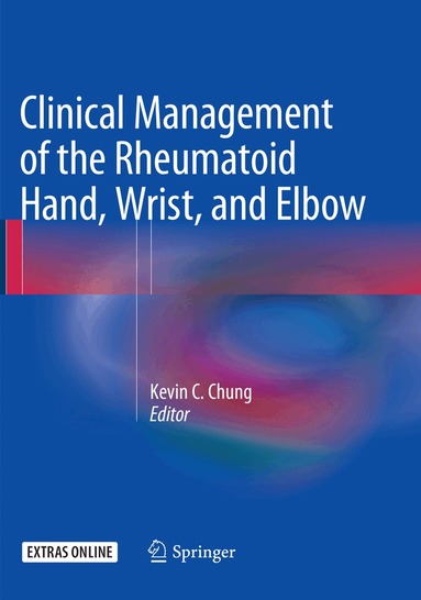 Kevin C. Chung - Clinical Management of the Rheumatoid Hand, Wrist, and Elbow, Häftad