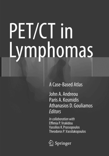 John A. Andreou, Paris A. Kosmidis, Athanasios D. Gouliamos - PET/CT in Lymphomas, Häftad