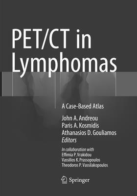 John A. Andreou, Paris A. Kosmidis, Athanasios D. Gouliamos, John a. Andreou - PET/CT in Lymphomas, Häftad