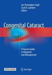 bokomslag Congenital Cataract