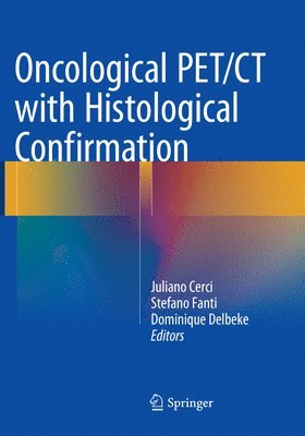 bokomslag Oncological PET/CT with Histological Confirmation