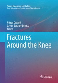 bokomslag Fractures Around the Knee