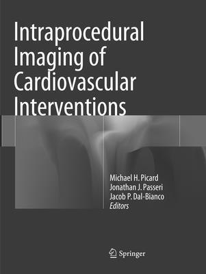 bokomslag Intraprocedural Imaging of Cardiovascular Interventions