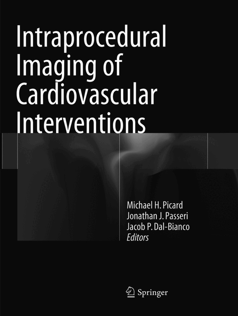Intraprocedural Imaging of Cardiovascular Interventions