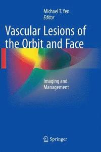 bokomslag Vascular Lesions of the Orbit and Face
