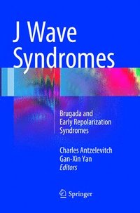 bokomslag J Wave Syndromes