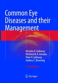 bokomslag Common Eye Diseases and their Management