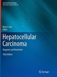 bokomslag Hepatocellular Carcinoma