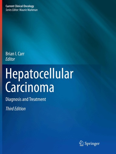 Brian I. Carr - Hepatocellular Carcinoma, Häftad