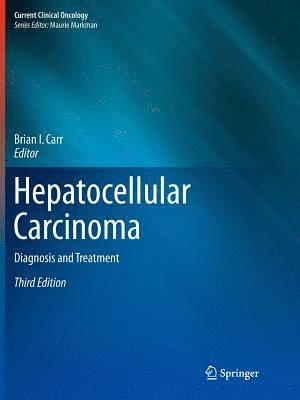 Brian I. Carr - Hepatocellular Carcinoma, Häftad