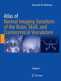 bokomslag Atlas of Normal Imaging Variations of the Brain, Skull, and Craniocervical Vasculature