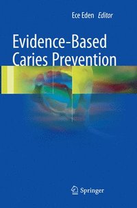 bokomslag Evidence-Based Caries Prevention