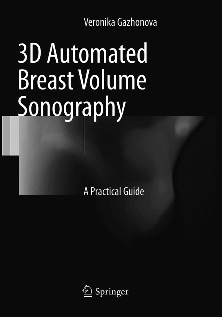 Veronika Gazhonova - 3D Automated Breast Volume Sonography, Häftad