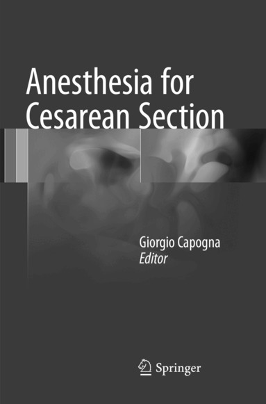 Giorgio Capogna - Anesthesia for Cesarean Section, Häftad