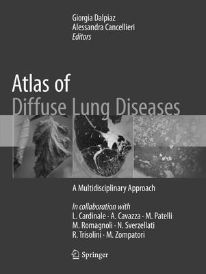 bokomslag Atlas of Diffuse Lung Diseases