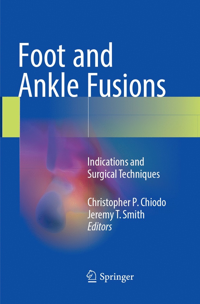 Christopher P. Chiodo, Jeremy T. Smith - Foot and Ankle Fusions, Häftad