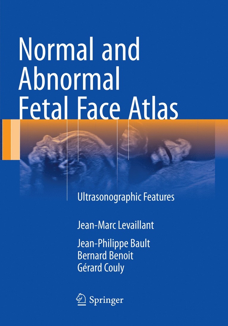 Jean-Marc Levaillant, Jean-Philippe Bault, Bernard Benoit, Gérard Couly, Gerard Couly - Normal and Abnormal Fetal Face Atlas, Häftad