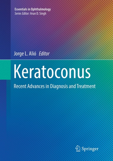 bokomslag Keratoconus