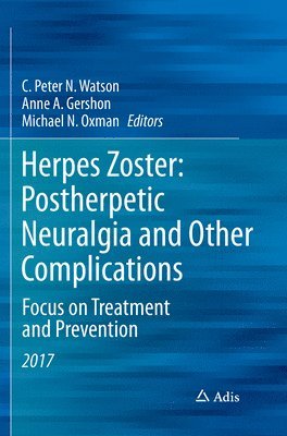 C. Peter N. Watson, Anne A. Gershon, Michael N. Oxman - Herpes Zoster: Postherpetic Neuralgia and Other Complications, Häftad