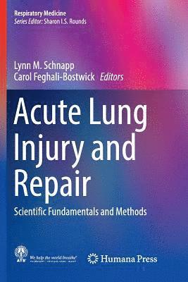 bokomslag Acute Lung Injury and Repair