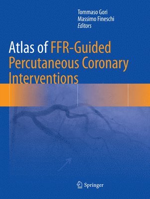 Atlas of FFR-Guided Percutaneous Coronary Interventions 1