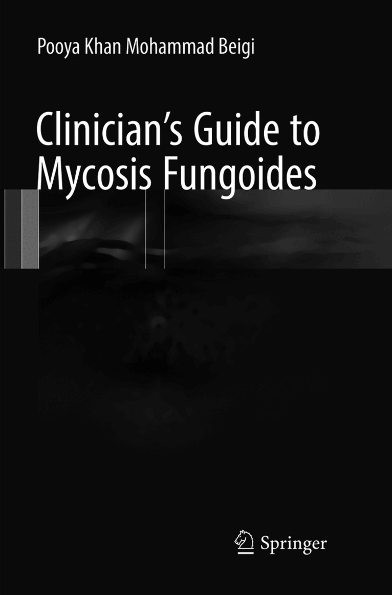 Clinician's Guide to Mycosis Fungoides
