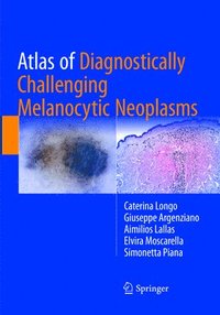 bokomslag Atlas of Diagnostically Challenging Melanocytic Neoplasms