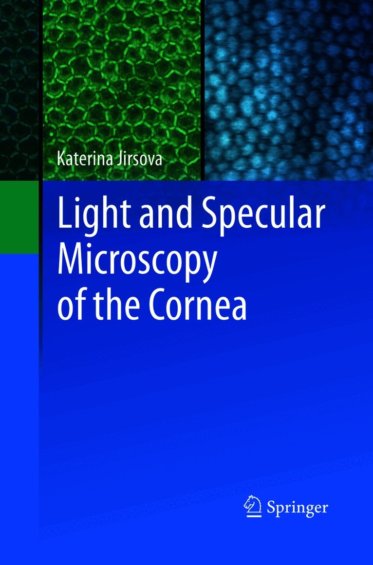 Light and Specular Microscopy of the Cornea